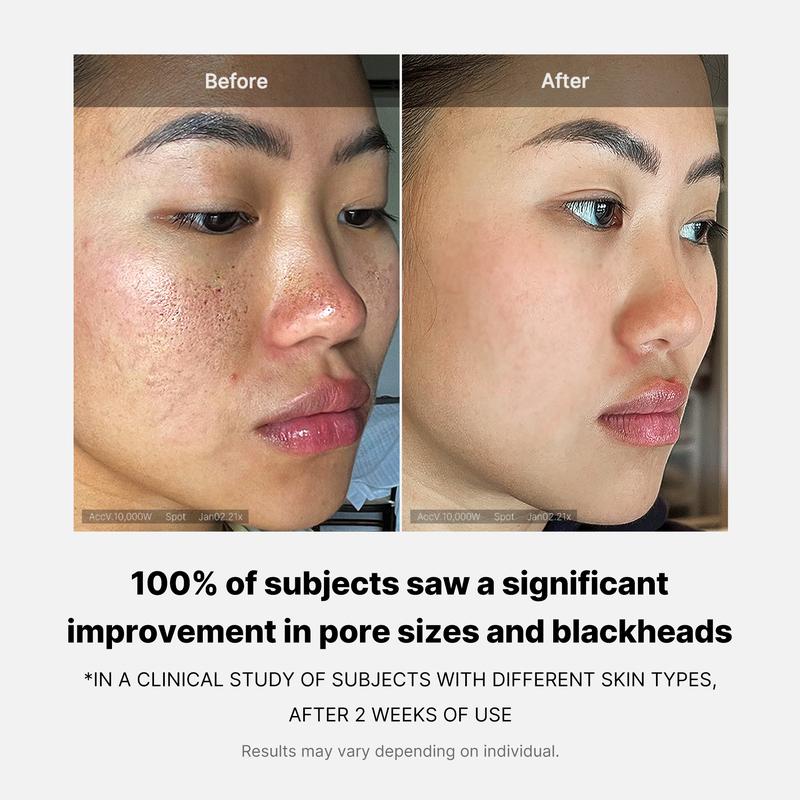 No pore pads