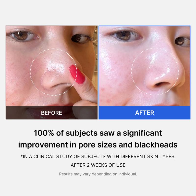 No pore pads
